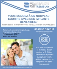 Bienvenue à nos soirées d'information en implantologie dentaire