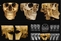 Radiographie 3D
