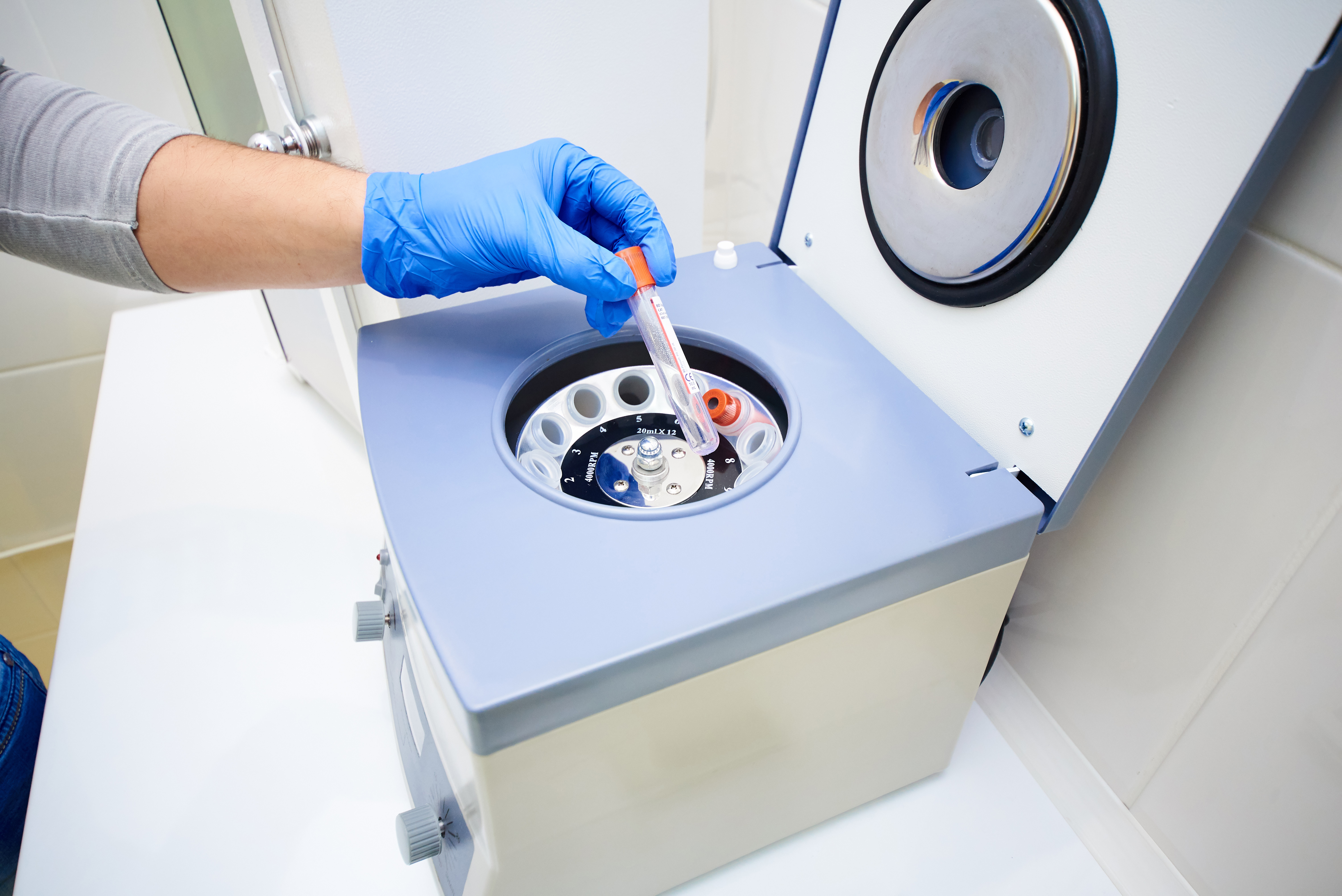 Regenerative Dentistry uses a centrifuge to extract PRF